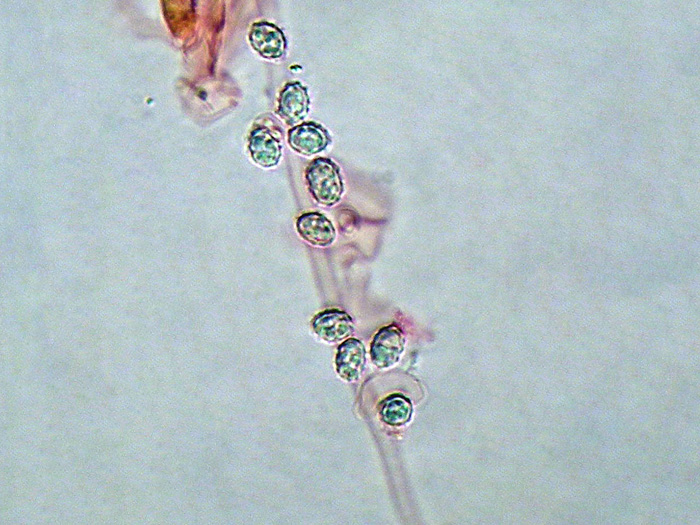 Crosta bianca da determinare  (Trechispora fastidiosa)